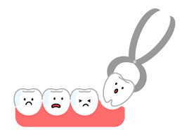 乳歯の抜歯についてのアイキャッチ画像