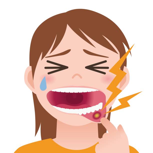 口腔粘膜疾患についてのアイキャッチ画像