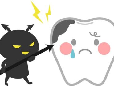 虫歯の原因についてのアイキャッチ画像