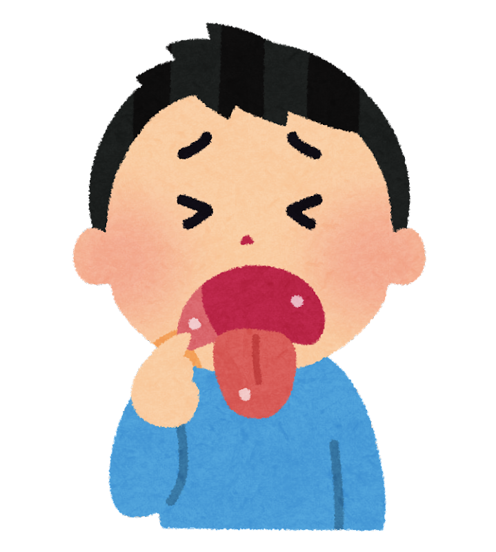 口内炎についてのアイキャッチ画像