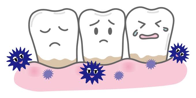 プラークが歯石に変化するまでの日数のアイキャッチ画像