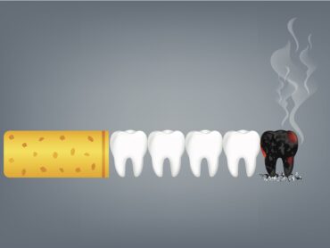 喫煙と歯周病の関連性のアイキャッチ画像