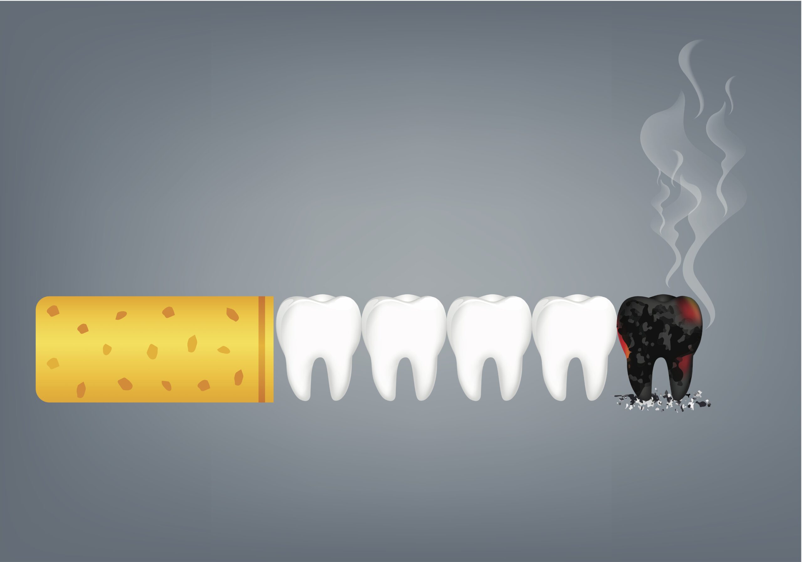 喫煙と歯周病の関連性のアイキャッチ画像