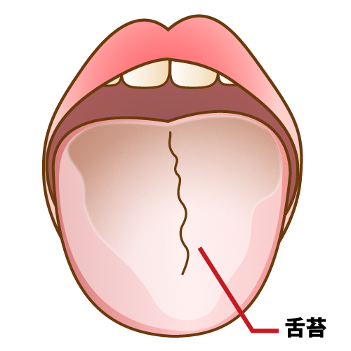 口臭の原因　舌苔についてのアイキャッチ画像